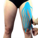 Taping kinesiologico, la tecnica 100% naturale, conquista i professionisti dell’estetica