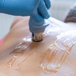 Perché il fisioterapista usa la crema per la Tecar Terapia